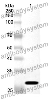 Anti-MTX1 Polyclonal Antibody