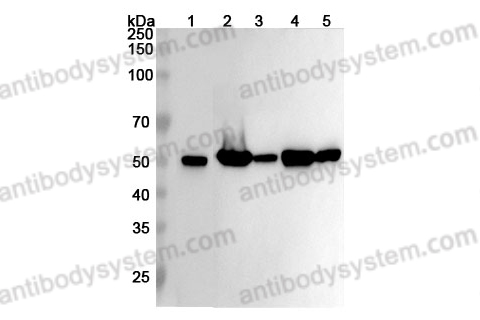 Anti-TUBB3 Polyclonal Antibody