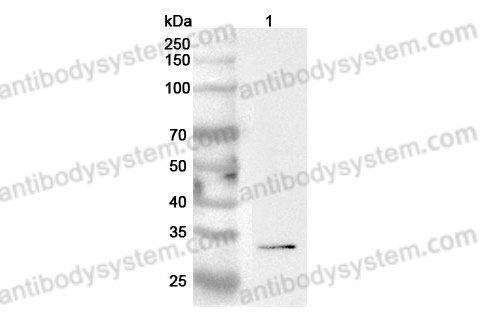 Anti-Human OLIG2 Polyclonal Antibody