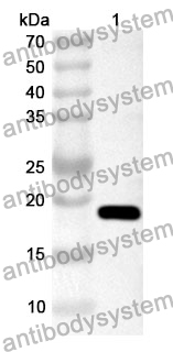 Anti-Human CAMK2G Polyclonal Antibody