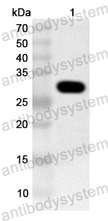 Anti-Human PKD2 Polyclonal Antibody