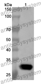 Anti-Human TDG Polyclonal Antibody