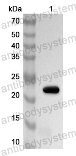 Anti-Human SNW1 Polyclonal Antibody