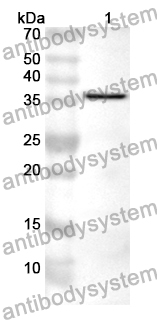 Anti-DGKZ Polyclonal Antibody