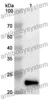 Anti-STIM1 Polyclonal Antibody