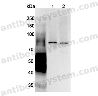 Anti-Human SNX1 Polyclonal Antibody