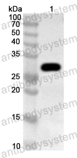 Anti-Human CUL2 Polyclonal Antibody