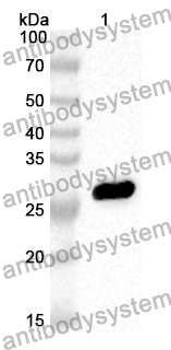 Anti-Human CUL4B Polyclonal Antibody