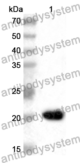 Anti-Human RAB31 Polyclonal Antibody