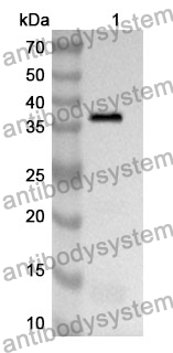 Anti-TPBG Polyclonal Antibody