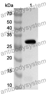 Anti-Human FHL1 Polyclonal Antibody