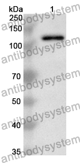 Anti-Human LAMC2 Polyclonal Antibody