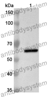 Anti-Human LAMC2 Polyclonal Antibody