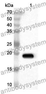 Anti-SPTAN1 Polyclonal Antibody