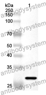 Anti-ENPP2 Polyclonal Antibody