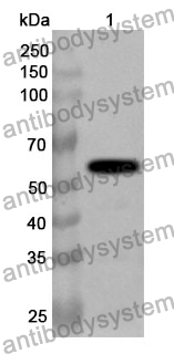 Anti-PKP1 Polyclonal Antibody