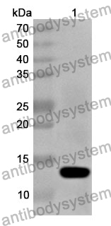 Anti-KLF5 Polyclonal Antibody