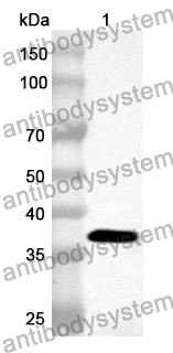 Anti-Human PRKG1 Polyclonal Antibody