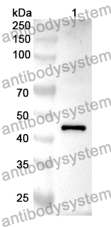 Anti-CAMK1 Polyclonal Antibody