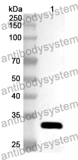 Anti-Human COX17 Polyclonal Antibody