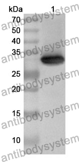 Anti-NID2 Polyclonal Antibody