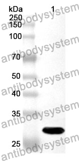 Anti-LRP8 Polyclonal Antibody