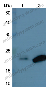 Anti-IL18 Polyclonal Antibody