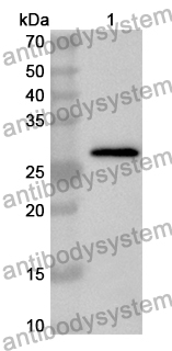 Anti-Human DAG1/Dystroglycan Polyclonal Antibody