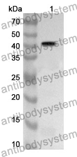 Anti-PDE1C Polyclonal Antibody