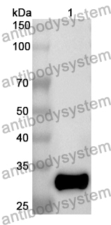 Anti-Human DSG2 Polyclonal Antibody