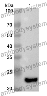 Anti-Human TRIM14 Polyclonal Antibody