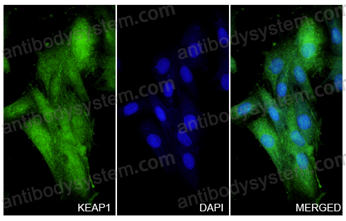 Anti-KEAP1 Polyclonal Antibody