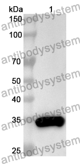 Anti-KEAP1 Polyclonal Antibody