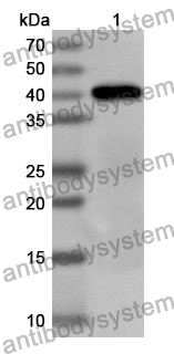 Anti-Human GIT2 Polyclonal Antibody