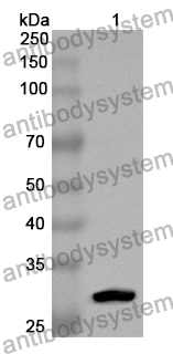 Anti-DOC2A Polyclonal Antibody