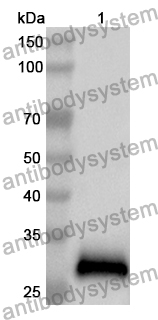 Anti-DOC2B Polyclonal Antibody