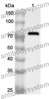 Anti-TFDP1 Polyclonal Antibody