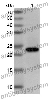 Anti-Human FHL2 Polyclonal Antibody