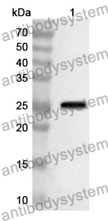 Anti-EBI3/IL27B Polyclonal Antibody