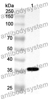 Anti-Human EIF2B1 Polyclonal Antibody