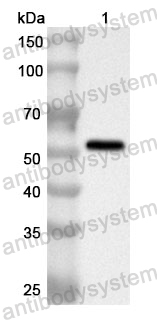 Anti-Human CTTN Polyclonal Antibody