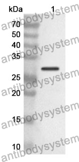 Anti-FGL2 Polyclonal Antibody