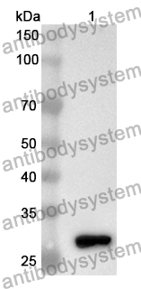 Anti-Human FZD2 Polyclonal Antibody