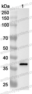 Anti-Human GALE Polyclonal Antibody