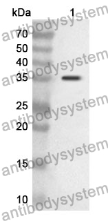 Anti-GAS6 Polyclonal Antibody