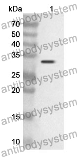 Anti-GRB7 Polyclonal Antibody