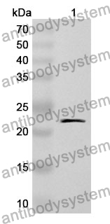 Anti-Human RBM39 Polyclonal Antibody