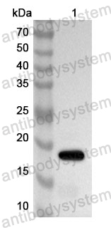 Anti-Human SCN5A Polyclonal Antibody