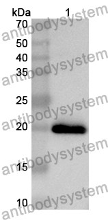 Anti-HLTF Polyclonal Antibody