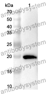 Anti-KRT81 Polyclonal Antibody